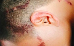 Chèn ép trên đường, tài xế xe ben gọi người đánh tài xế xe khách bầm dập