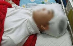Tạm giam nam sinh lớp 11 đánh bạn vỡ sọ não