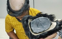 Giấu vàng dưới tóc giả để qua mặt hải quan sân bay