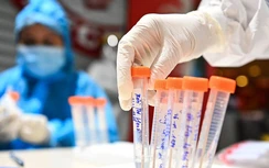 Thanh niên Hà Nam dương tính với Sars-CoV-2, xác định 232 F1, F2
