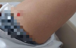 Một người đàn ông ở TP.HCM bị bắn nhiều phát súng vào ngực, đùi