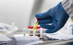 Sáng 26/5: 78/80 ca mắc mới Covid-19 phát hiện tại Bắc Giang, Bắc Ninh