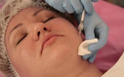 Nga cảnh báo không tiêm vaccine Covid-19 khi đang làm đẹp bằng Botox