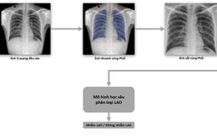 VinBrain phát hành sách trắng về ứng dụng AI chẩn đoán và tầm soát bệnh lao