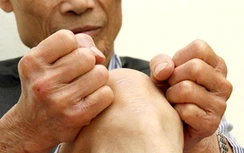 Những lưu ý với thoái hóa khớp gối ở người cao tuổi