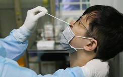 Đã có kết quả xét nghiệm của tài xế nghi nhiễm Covid-19 ở Cần Thơ
