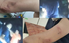 Kinh hoàng phóng viên bị đối tượng cầm cuốc nhằm đầu bổ tới tấp