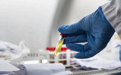 Bộ Y tế cho phép tiêm mũi 2 vaccine Pfizer cho người tiêm mũi 1 AstraZeneca