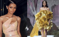 Người mẫu chuyển giới Châu Kim Sang bị u xương di căn, sức khỏe giờ ra sao?