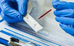 Loạn dịch vụ xét nghiệm kháng thể Covid-19