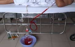 Lái xe ba gác bị thương tật 49% sau va chạm xe buýt, không khởi tố hình sự?