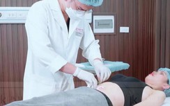 Sự thật liệu pháp căng chỉ giảm mỡ siêu tốc