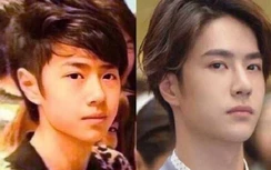 Vương Nhất Bác bị bác sĩ phẫu thuật thẩm mỹ "gọi tên"