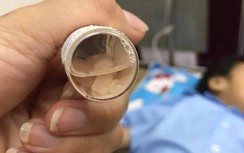 Bé gái 3 tuổi nghi bị bắn 9 chiếc đinh vào đầu: Đã bàn giao 1 đối tượng