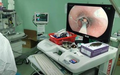 Người phụ nữ nhập viện cấp cứu khẩn vì... uống thuốc cả vỏ