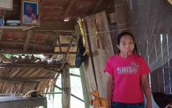 Điều kỳ diệu đến với người phụ nữ “34 năm mơ ước có khuôn mặt con người”