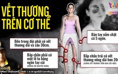 Mỹ nữ "Chiếc lá cuốn bay" có chi chít vết thương, xuất hiện chi tiết lạ?