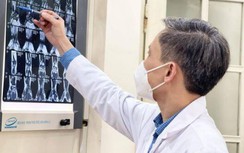 Lần đầu tiên tại Việt Nam thành công nội soi tái tạo khớp cổ tay