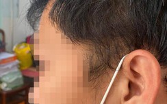 Nguyên Chủ tịch phường ở Đắk Lắk bị tố hành hung nhân viên y tế