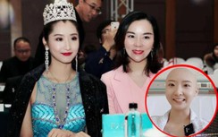 Hoa hậu đình đám qua đời ở tuổi 29: Xót xa lời tâm sự lúc cuối đời