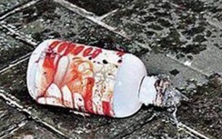 7 người bị tạt axit sau cuộc cãi vã, kẻ gây ra sự việc đang hôn mê