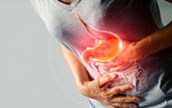 Ung thư dạ dày triệu chứng mơ hồ, dễ nhầm lẫn; cách nào phát hiện sớm?