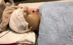 Lộ nguyên nhân Phó Chủ tịch UBND xã ở Hải Dương bị đánh vỡ hộp sọ