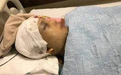 Bài học từ vụ Phó chủ tịch xã bị đánh vỡ hộp sọ