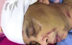 Vụ Phó Chủ tịch xã ở Hải Dương bị đánh: Các nạn nhân lần đầu lên tiếng