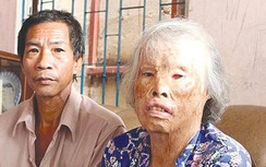 Chuyện đời nữ giao liên bị bom napan lấy chồng kém 18 tuổi