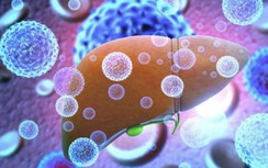 Một nước Đông Nam Á phát hiện ca nhiễm viêm gan không rõ nguyên nhân