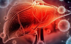 Viêm gan “bí ẩn” ở trẻ em: Bộ Y tế yêu cầu giám sát chặt