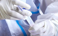 Cán bộ tỉnh Trà Vinh nhận quà từ Việt Á đều đã nộp lại?