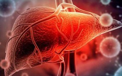 Bộ Y tế liên tiếp ra văn bản yêu cầu giám sát chặt bệnh viêm gan "bí ẩn"