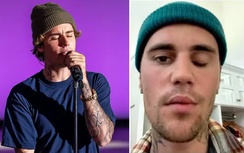 Một ca sĩ đình đám bất ngờ bị liệt nửa mặt, sự nghiệp ảnh hưởng ra sao?