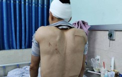 Người bị truy sát ở cổng Bệnh viện Mắt Hải Phòng nghi do va chạm giao thông