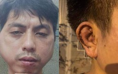 Vụ nhân viên xin nghỉ việc bị đánh biến dạng mặt: Chủ quán khai nhận gì?