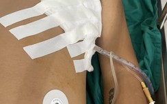 20 côn đồ truy sát đâm chém khiến một thanh niên trọng thương