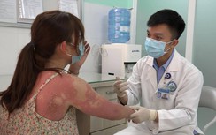 Một phụ nữ bị hoại tử thượng bì nhiễm độc nặng sau khi dùng TPCN