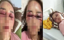 Thông tin mới vụ cán bộ quản lý thị trường bị tố hành hung phụ nữ