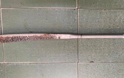 Mâu thuẫn khi mua cá viên chiên, nhóm thanh niên chém lìa tay khách