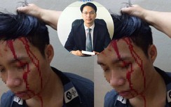 Con trai mua tiết lợn bịa bị bắt cóc tống tiền mẹ đối diện hình phạt gì?