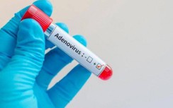 Đừng tốn tiền triệu tự ý làm xét nghiệm Adeno virus cho trẻ