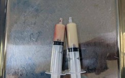 Huyết tương trắng đục như sữa vì mỡ máu tăng cao