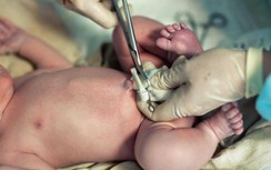 Gửi tế bào gốc máu cuống rốn mất vài chục triệu đồng, có thực sự cần thiết?