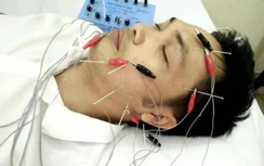 Thời tiết lạnh sâu, không chủ quan khi đột ngột tê mặt, lệch miệng