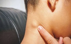 Nổi hạch ở cổ có đáng lo?