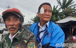 Tài xế xe Sơn Tùng tố bị đánh tới tấp khi đón khách tại Quảng Ngãi