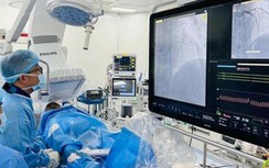 Bất ngờ phát hiện nhồi máu cơ tim cấp khi đi nội soi dạ dày