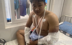 Lời kể của nam shipper thời điểm bị đánh gãy cả hai tay